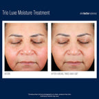 SkinBetter Science | Trio Luxe