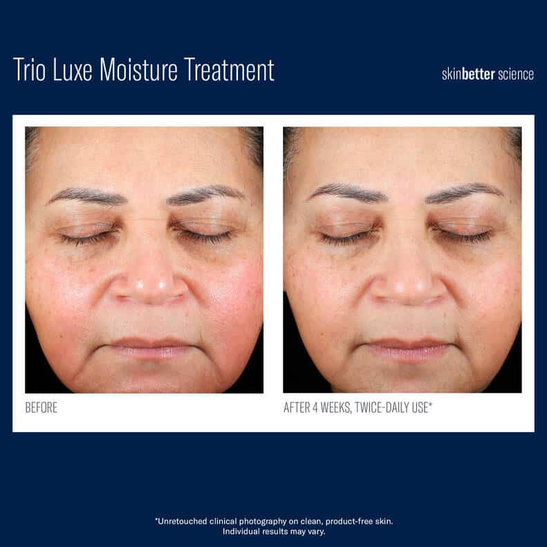 SkinBetter Science | Trio Luxe