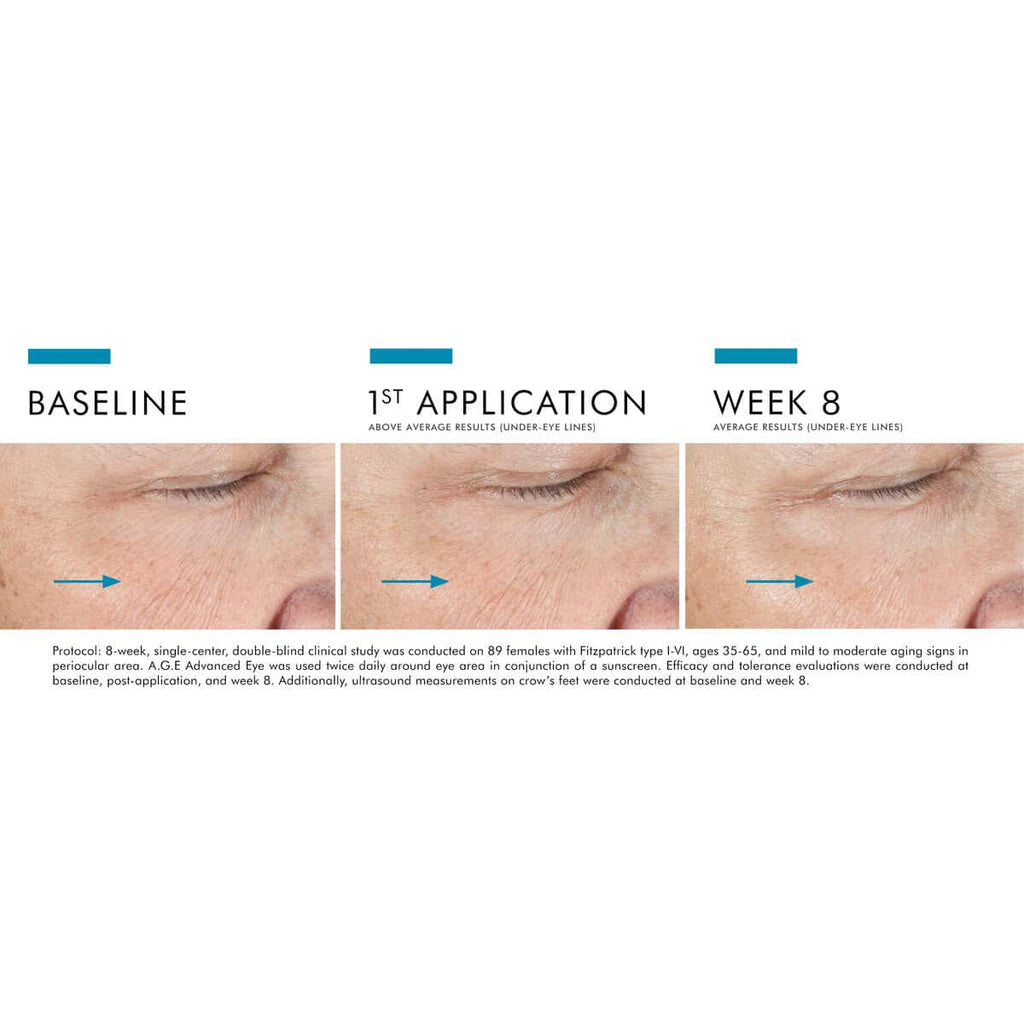SkinCeuticals A.G.E. Advanced Eye