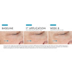 SkinCeuticals A.G.E. Advanced Eye