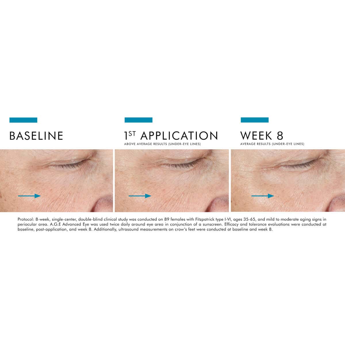 SkinCeuticals A.G.E. Advanced Eye