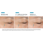 SkinCeuticals A.G.E. Advanced Eye