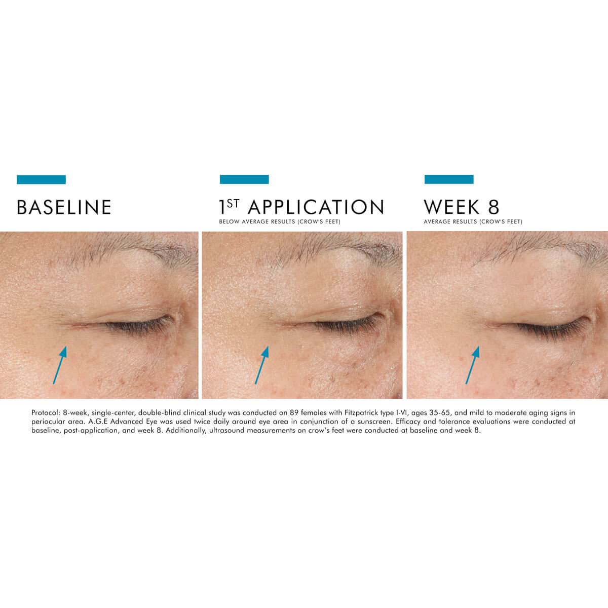 SkinCeuticals A.G.E. Advanced Eye