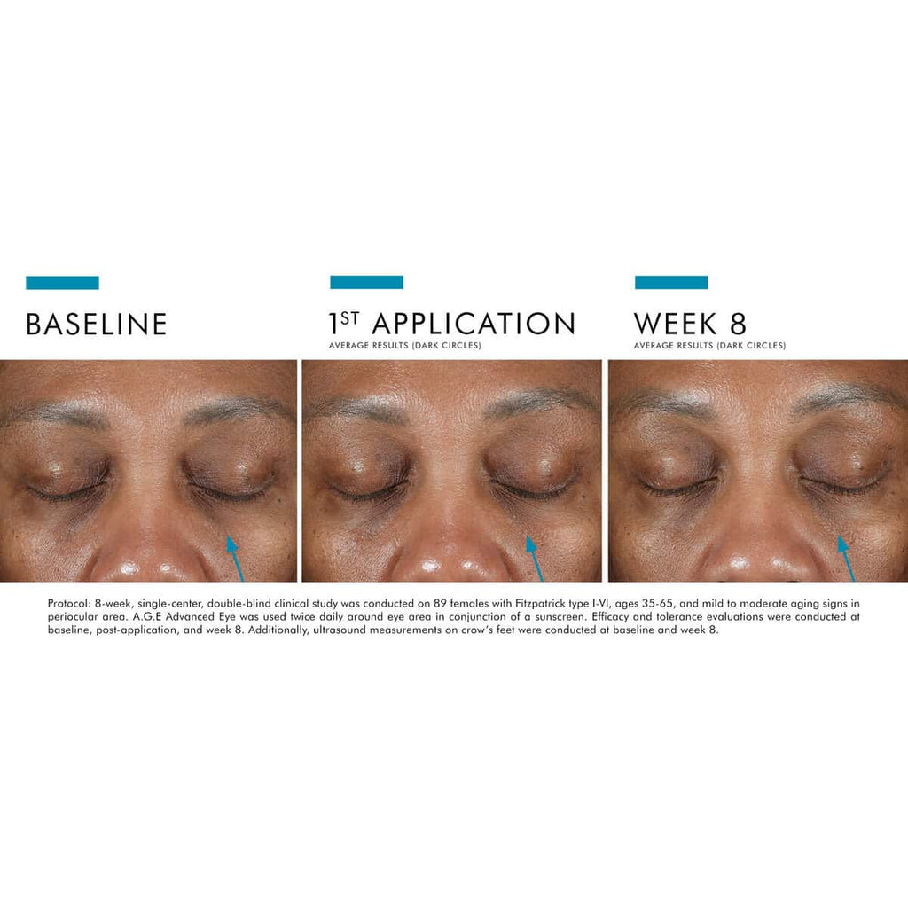 SkinCeuticals A.G.E. Advanced Eye