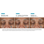 SkinCeuticals A.G.E. Advanced Eye