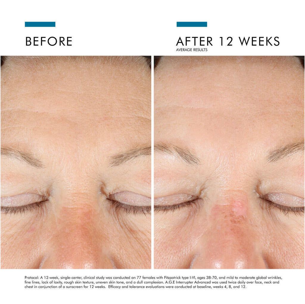 SkinCeuticals A.G.E. Interrupter Advanced