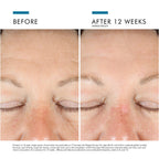 SkinCeuticals A.G.E. Interrupter Advanced