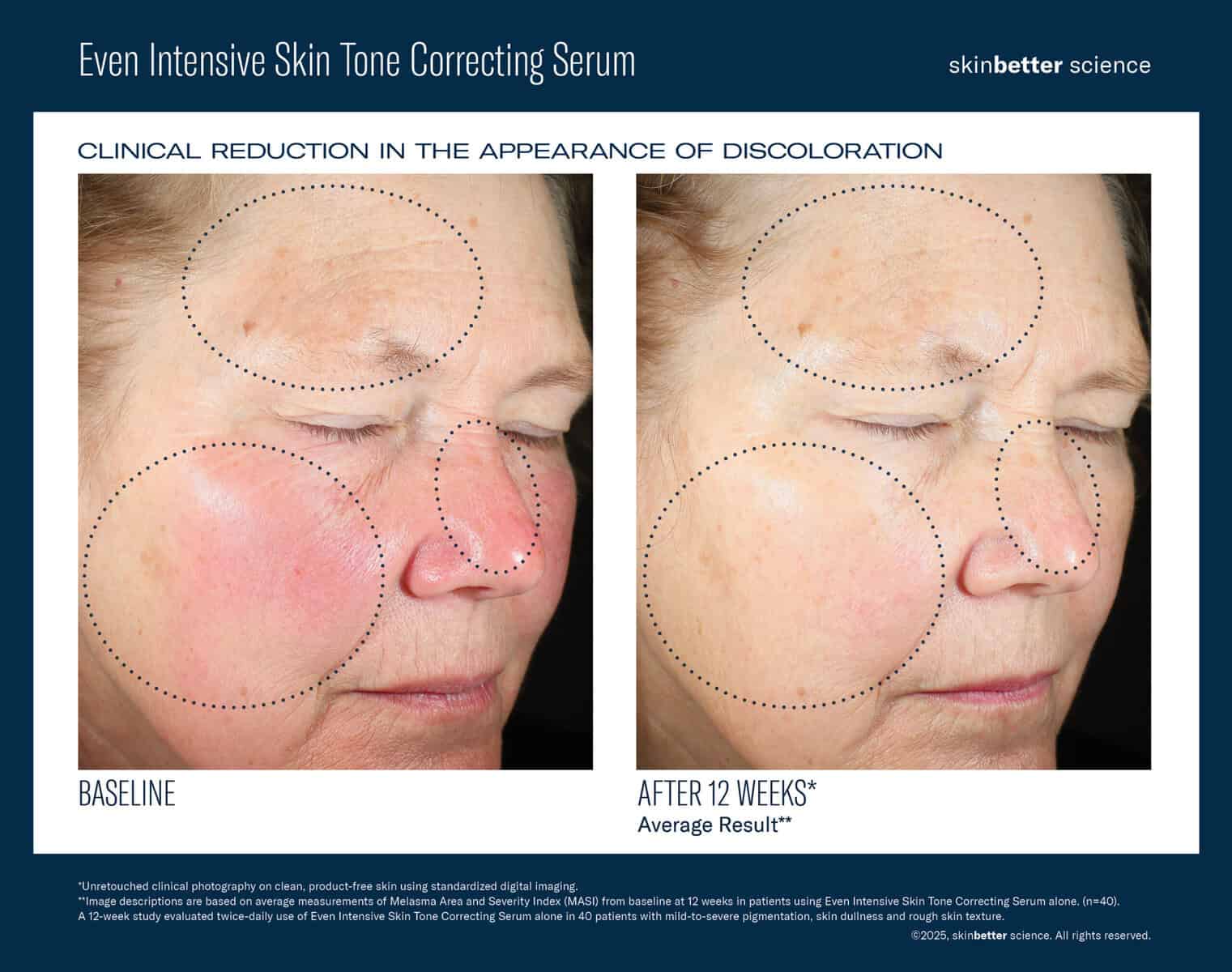 Before and after images showing skin tone improvement with serum.