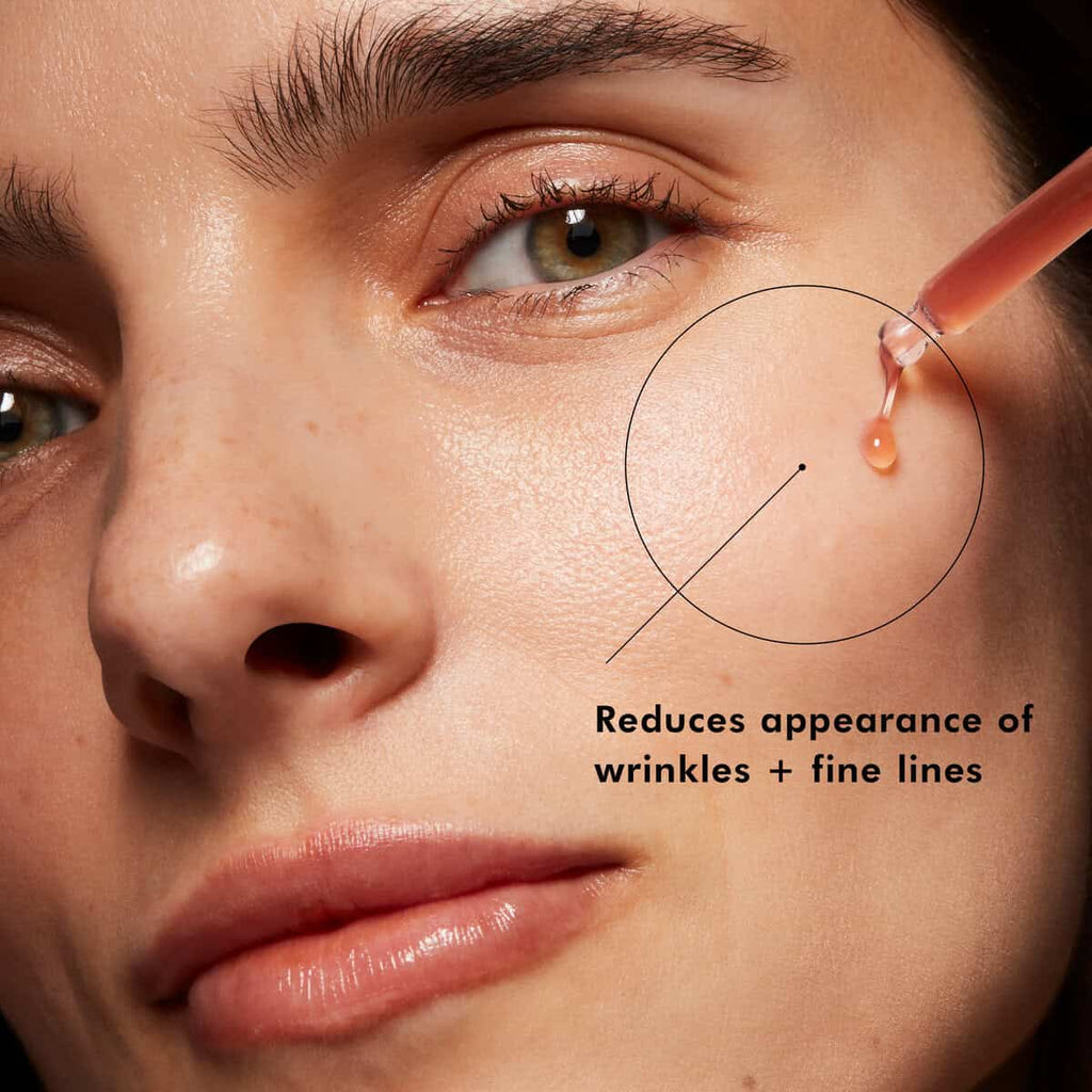 Close-up of a woman receiving dermal filler treatment for skin rejuvenation at SF Wellness.