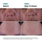 [NEW] SkinCeuticals P-TIOX Anti-Wrinkle Cream