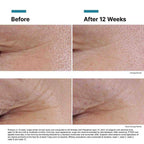 SkinCeuticals P-TIOX Anti-Wrinkle Serum
