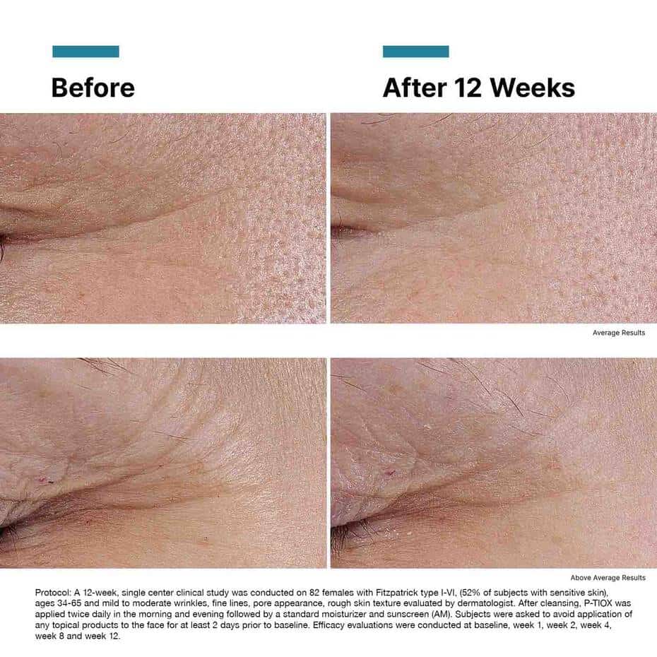 SkinCeuticals P-TIOX Anti-Wrinkle Serum