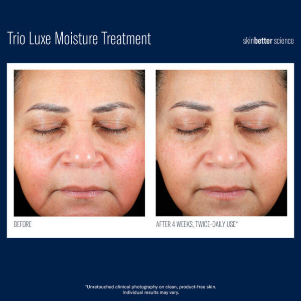 SkinBetter Science | Trio Luxe - Image 2